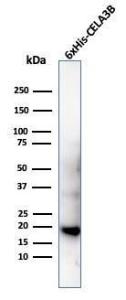 Western blot analysis of recombinant His tagged CELA3B protein using Anti-His Tag Antibody [6HIS/6402R]