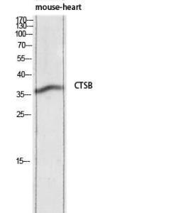 Anti-Cathepsin B Rabbit Polyclonal Antibody