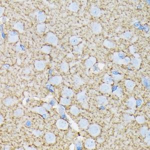 Immunohistochemistry analysis of paraffin-embedded rat brain using Anti-EAAT1 Antibody [ARC1714] (A306133) at a dilution of 1:100 (40x lens) Perform microwave antigen retrieval with 10 mM Tris/EDTA buffer pH 90 before commencing with IHC staining protocol