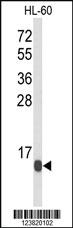 Anti-RPLP2 Rabbit Polyclonal Antibody