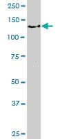 Anti-BUB1 Rabbit Polyclonal Antibody