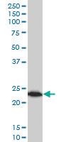 Anti-TPT1 Mouse Monoclonal Antibody [clone: 2C4]