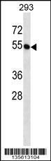 Anti-BTN2A1 Rabbit Polyclonal Antibody (FITC (Fluorescein Isothiocyanate))