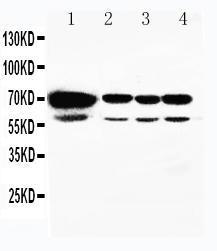 Anti-HSPA2 Rabbit Polyclonal Antibody