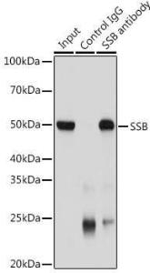 Anti-SSB antibody