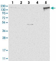 Anti-PSD4 Rabbit Polyclonal Antibody