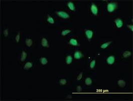 Anti-SETX Mouse Monoclonal Antibody [clone: 2A9]