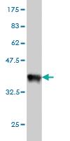 Anti-MUC4 Mouse Monoclonal Antibody [clone: 5B12]