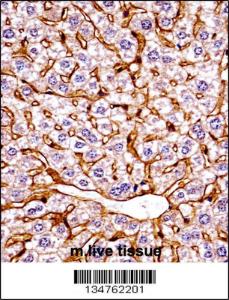 Anti-EIF2AK4 Rabbit Polyclonal Antibody