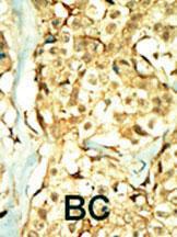 Anti-TNIK Rabbit Polyclonal Antibody (HRP (Horseradish Peroxidase))