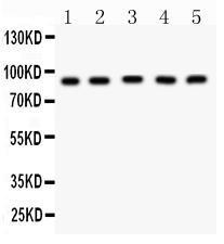 Anti-CPT1B Rabbit Polyclonal Antibody