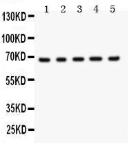 Anti-Menin Polyclonal Antibody