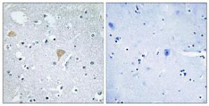 Immunohistochemical analysis of paraffin-embedded human brain tissue using Anti-CTRO Antibody. The right hand panel represents a negative control, where the Antibody was pre-incubated with the immunising peptide