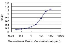 Anti-LRRFIP1 Mouse Monoclonal Antibody [clone: 3E1]