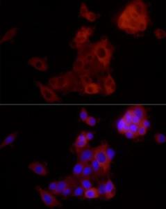 Immunofluorescence analysis of HepG2 using Anti-ALDH1A1 Antibody [ARC52440] (A309053) at a dilution of 1:800 (40x lens). DAPI was used to stain the cell nuclei (blue)