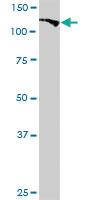 Anti-BUB1 Rabbit Polyclonal Antibody