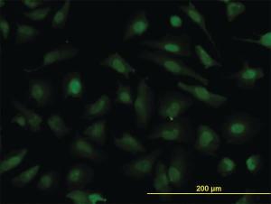 Anti-NUP133 Mouse Monoclonal Antibody [clone: 3E8]