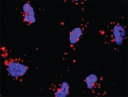 Anti-CDKN1A + HDAC1 Antibody Pair