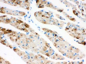 Anti-CPT1B Rabbit Polyclonal Antibody