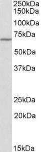 Anti-THEMIS Antibody (A84799) (03 µg/ml) staining of Mouse Spleen lysate (35 µg protein in RIPA buffer) Primary incubation was 1 hour Detected by chemiluminescence