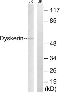 Anti-DKC1 Rabbit Polyclonal Antibody