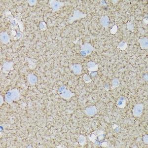 Immunohistochemistry analysis of paraffin-embedded human brain tissue using Anti-EAAT1 Antibody [ARC1714] (A306133) at a dilution of 1:100 (40x lens) Perform microwave antigen retrieval with 10 mM Tris/EDTA buffer pH 90 before commencing with IHC staining protocol