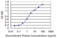 Anti-ADCYAP1R1 Mouse Monoclonal Antibody [clone: 2B12]