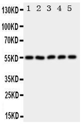 Anti-HYAL2 Rabbit Polyclonal Antibody