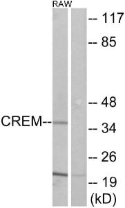 Western blot analysis of lysates from RAW264.7 cells using Anti-CREM Antibody. The right hand lane represents a negative control, where the antibody is blocked by the immunising peptide