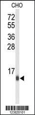 Anti-RPLP2 Rabbit Polyclonal Antibody