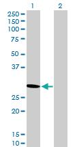 Anti-PSME2 Mouse Polyclonal Antibody