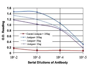 Anti-GCK Mouse Monoclonal Antibody [clone: 4G6]