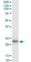 Anti-TPT1 Mouse Monoclonal Antibody [clone: 2C4]