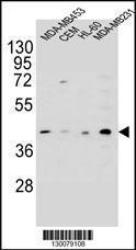 Anti-HHLA2 Rabbit Polyclonal Antibody