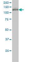 Anti-HDAC5 Mouse Monoclonal Antibody [clone: 4G2]