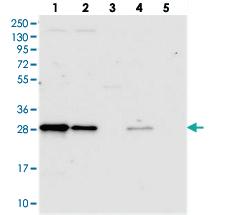 Anti-TRPS1 Rabbit Polyclonal Antibody