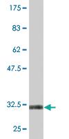 Anti-SLC2A4 Mouse Monoclonal Antibody [clone: 4A1]