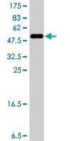 Anti-DIP2A Mouse Polyclonal Antibody