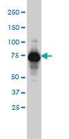 Anti-ADD1 Mouse Monoclonal Antibody [clone: 2C9]