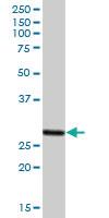 Anti-PSME2 Mouse Polyclonal Antibody