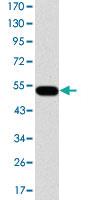 Anti-GCK Mouse Monoclonal Antibody [clone: 4G6]