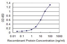 Anti-SETX Mouse Monoclonal Antibody [clone: 2A9]