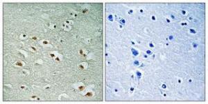 Immunohistochemical analysis of paraffin-embedded human brain using Anti-CREM Antibody 1:100 (4°C overnight). The right hand panel represents a negative control, where the antibody was pre-incubated with the immunising peptide