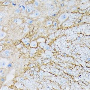 Immunohistochemistry analysis of paraffin-embedded mouse spinal cord using Anti-EAAT1 Antibody [ARC1714] (A306133) at a dilution of 1:100 (40x lens) Perform microwave antigen retrieval with 10 mM Tris/EDTA buffer pH 90 before commencing with IHC staining protocol