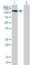 Anti-BUB1 Mouse Monoclonal Antibody [clone: 4C3-4C9]