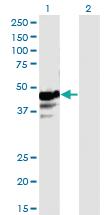 Anti-NAPRT Mouse Monoclonal Antibody [clone: 4A9]