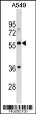 Anti-BTN2A3 Rabbit Polyclonal Antibody (HRP (Horseradish Peroxidase))