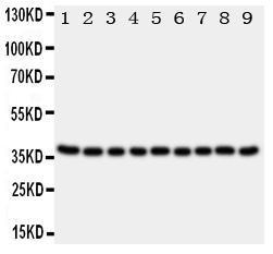 Anti-Kallikrein 10 Rabbit Polyclonal Antibody