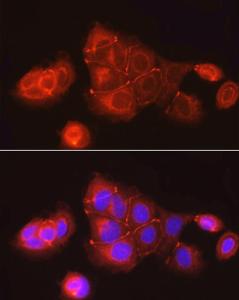 Immunofluorescence analysis of MCF7 cells using Anti-ZO1 tight junction protein Antibody (A8449) at a dilution of 1:100 (40x lens) DAPI was used to stain the cell nuclei (blue)