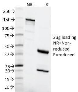 SDS-PAGE analysis of Anti-MSH6 Antibody [MSH6/2111] under non-reduced and reduced conditions; showing intact IgG and intact heavy and light chains, respectively SDS-PAGE analysis confirms the integrity and purity of the antibody